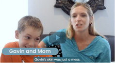 Eczema Video 2