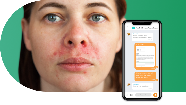 Telemedicine for Perioral Dermatitis img